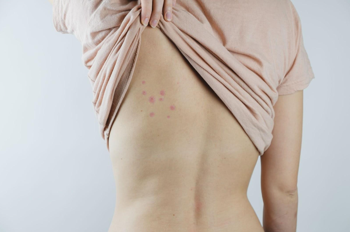 Infestation Signs Bed Bugs Infestation Signs Bed Bugs